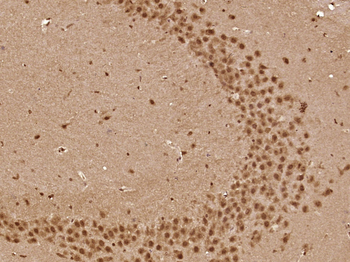 BRAF Rabbit Polyclonal Antibody