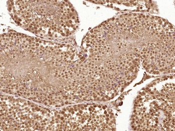 BRAF Rabbit Polyclonal Antibody