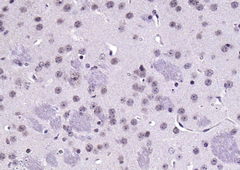 BRAF Rabbit Polyclonal Antibody
