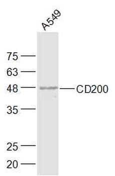 CD200 Rabbit Polyclonal Antibody