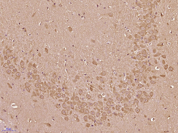 Neurochondrin Rabbit Polyclonal Antibody