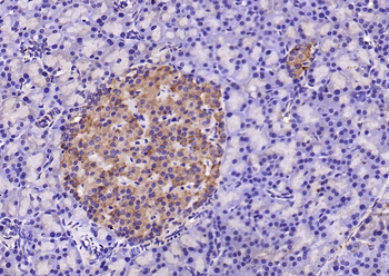 SOD2 Rabbit Polyclonal Antibody