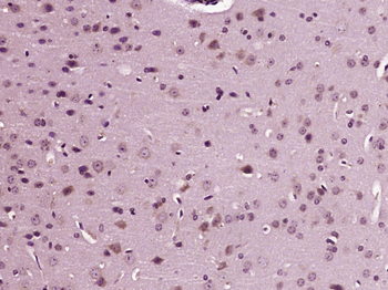 TRPV1 Rabbit Polyclonal Antibody