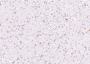 SIP1 Rabbit Polyclonal Antibody