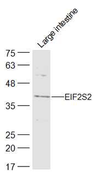 EIF2S2 Rabbit Polyclonal Antibody