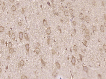 CLOCK Rabbit Polyclonal Antibody