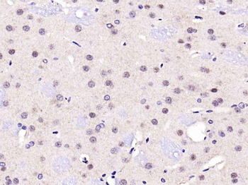 PARP1 Rabbit Polyclonal Antibody