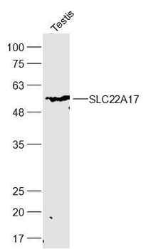 SLC22A17 Rabbit Polyclonal Antibody