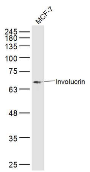 Involucrin Rabbit Polyclonal Antibody