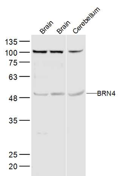 BRN4 Rabbit Polyclonal Antibody