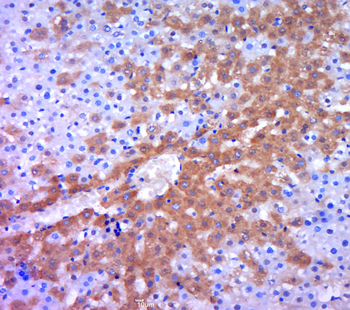 GSTP1 Rabbit Polyclonal Antibody