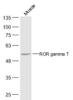 ROR gamma T Rabbit Polyclonal Antibody