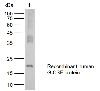 G-CSF Mouse Monoclonal Antibody