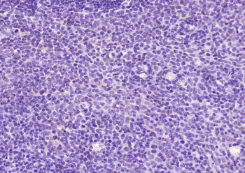 Bcl-2 Mouse Monoclonal Antibody