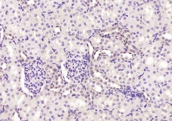 Bcl-2 Mouse Monoclonal Antibody