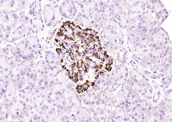 Bcl-2 Mouse Monoclonal Antibody