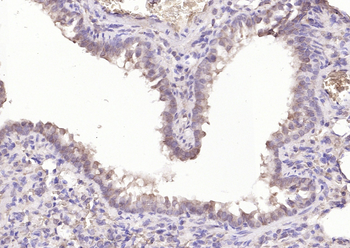 Bcl-2 Mouse Monoclonal Antibody