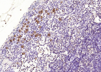 Bcl-2 Mouse Monoclonal Antibody