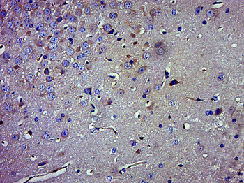 SGK1 Mouse Monoclonal Antibody