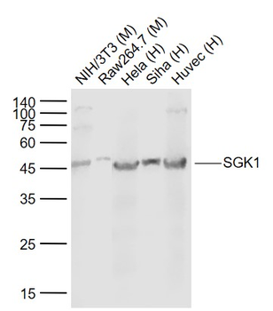 SGK1 Mouse Monoclonal Antibody