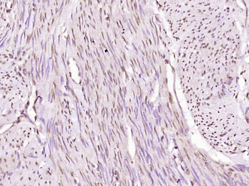 NF kB P65 (Acetyl-Lys314/Lys315) Mouse Monoclonal Antibody