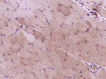 NEU2 Rabbit Polyclonal Antibody