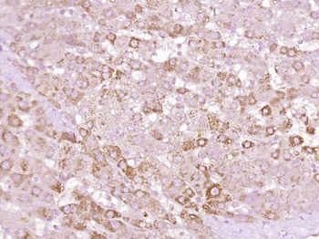 Mannan Binding Lectin Rabbit Polyclonal Antibody