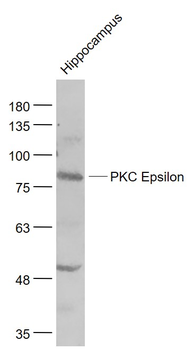 PKC Epsilon Rabbit Polyclonal Antibody