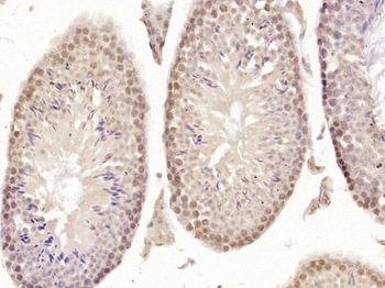 HRASLS5 Rabbit Polyclonal Antibody