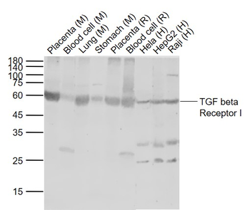 TGF beta Receptor I Rabbit Polyclonal Antibody