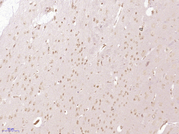 RRP15 Rabbit Polyclonal Antibody