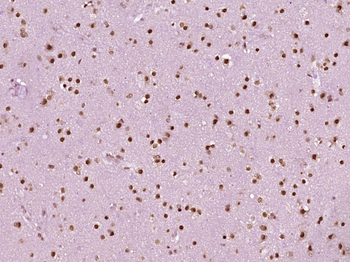 Adenylate kinase isoenzyme 6 Rabbit Polyclonal Antibody