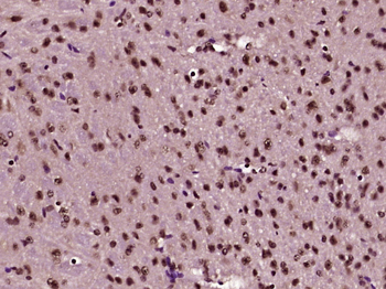 Adenylate kinase isoenzyme 6 Rabbit Polyclonal Antibody