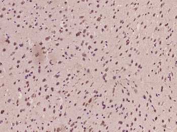 NG2 Rabbit Polyclonal Antibody