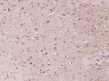 P2X2 Rabbit Polyclonal Antibody