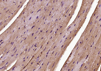 Muscle Actin Rabbit Polyclonal Antibody