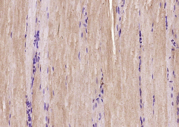 Muscle Actin Rabbit Polyclonal Antibody