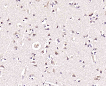 Topoisomerase I Rabbit Polyclonal Antibody