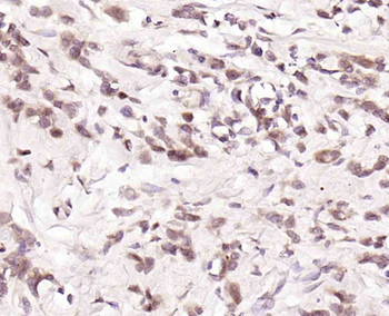 Topoisomerase I Rabbit Polyclonal Antibody