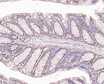 Topoisomerase I Rabbit Polyclonal Antibody