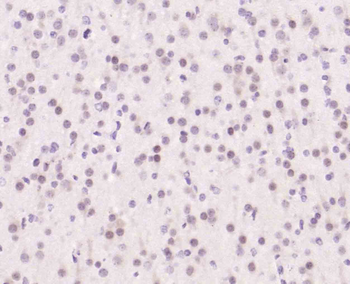 Topoisomerase I Rabbit Polyclonal Antibody