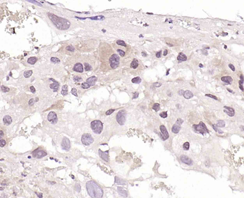 Topoisomerase I Rabbit Polyclonal Antibody