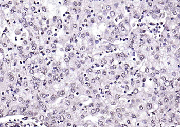 5 MethylCytosine Rabbit Polyclonal Antibody