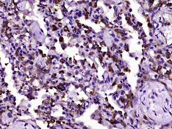 P53 (Acetyl K382) Mouse Monoclonal Antibody