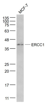 ERCC1 Mouse Monoclonal Antibody