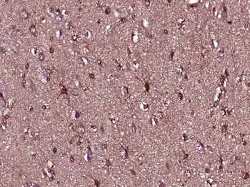 Peroxiredoxin 1 Mouse Monoclonal Antibody