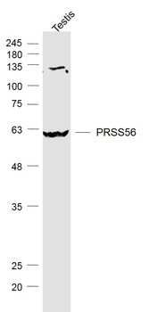 PRSS56 Rabbit Polyclonal Antibody