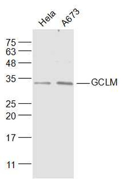 GCLM Rabbit Polyclonal Antibody
