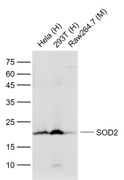 SOD2 Mouse Monoclonal Antibody