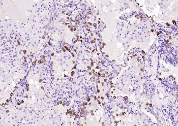 FASN Mouse Monoclonal Antibody